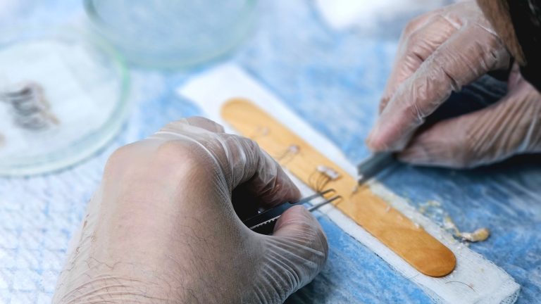 Machine Perfusion Aim Meets Organ Transplant System Gaps 2 Gloved hands practice suturing on a training pad